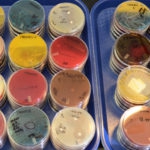 four trays of bacteriology culture plates in red, blue, yellow, and white