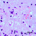 Photo of multple Neospora tachyzoites (arrows) in infected brain tissue of pink and purple color