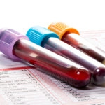 Three blood samples with lavender top, blue top, and orange tops are placed on a value recording sheet for testing.
