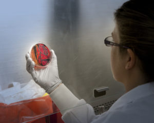 Woman with back to camera holding bacteria grown on red plate