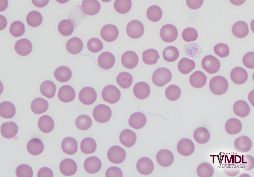 Photomicrograph depicting extracellular spirochete bacteria on blood smear.
