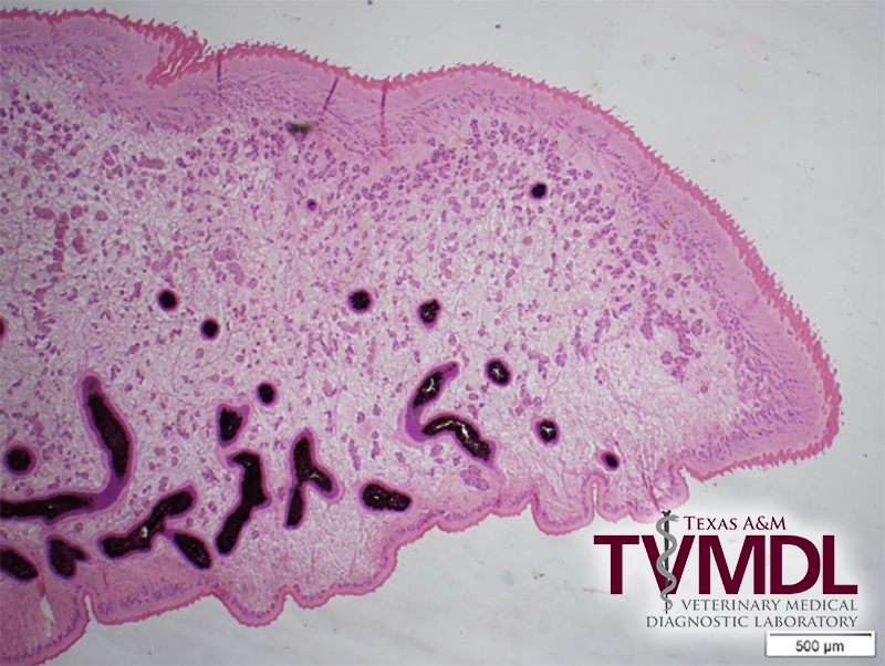 Photomicrograph depicting portion of a liver fluke.