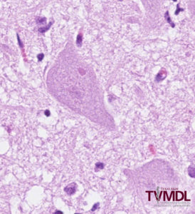 Figure 2. Photomicrograph depicting intracytoplasmic inclusions noted in individual neurons.