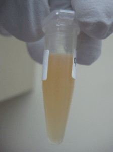 Tube with example of bad serum sample