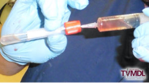 hands in light blue gloves holding a syringe and tube with light red liquid