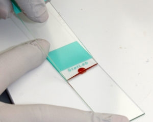 Hands in white gloves smearing blood on glass slides