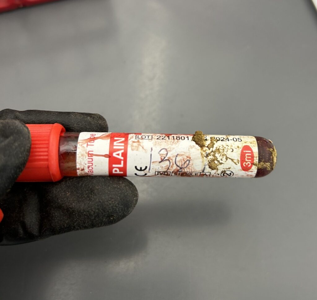 blood tube with illegible information due to blood and feces on tube