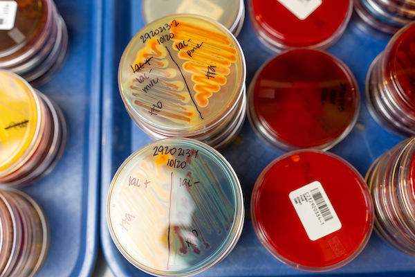 colorful bacterial plates on blue tray