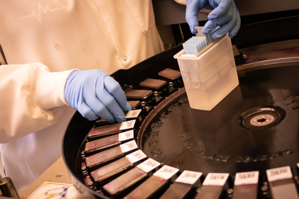 hands with blue gloves putting glass slides into piece of equipment