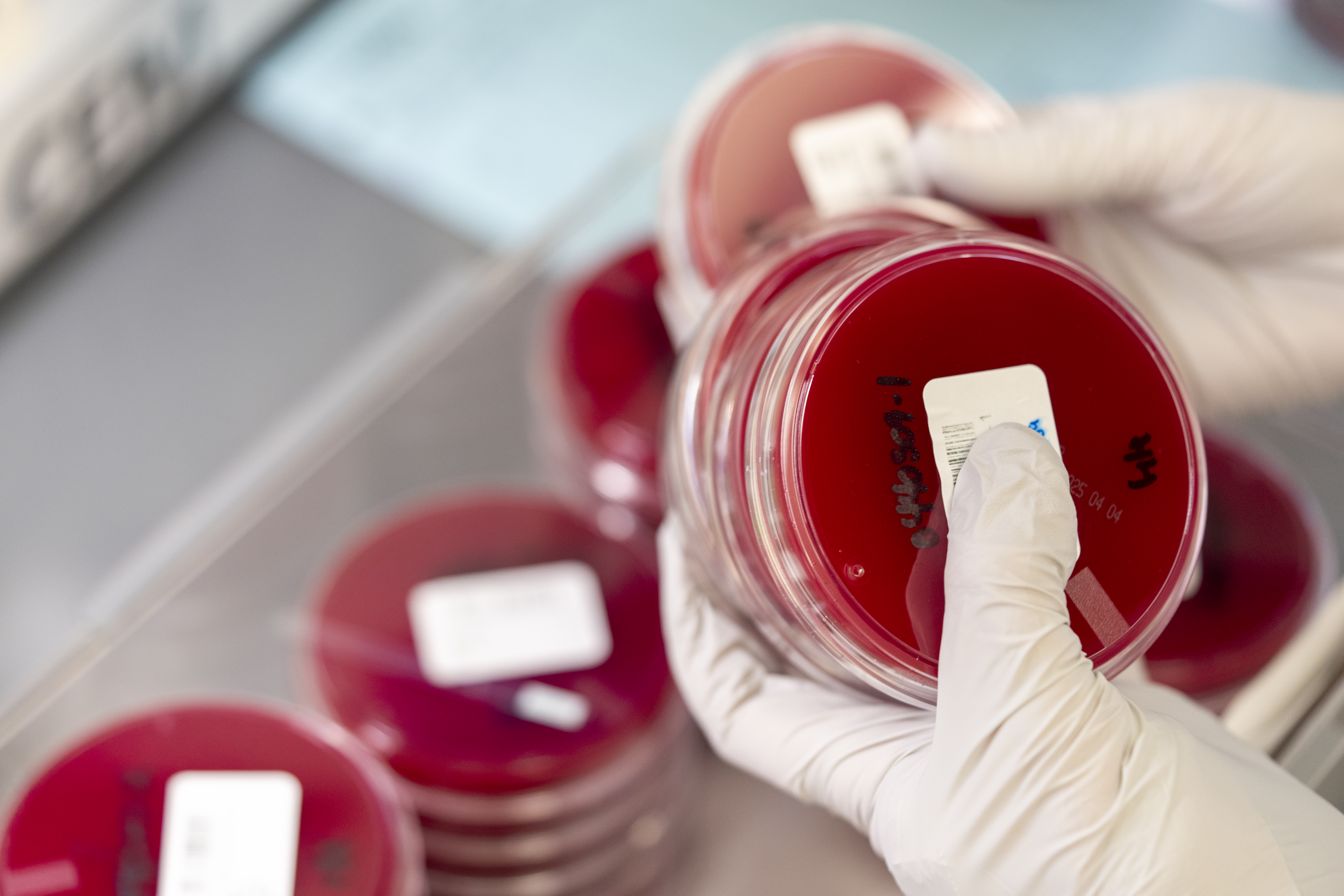 Agar plates in petri dishes